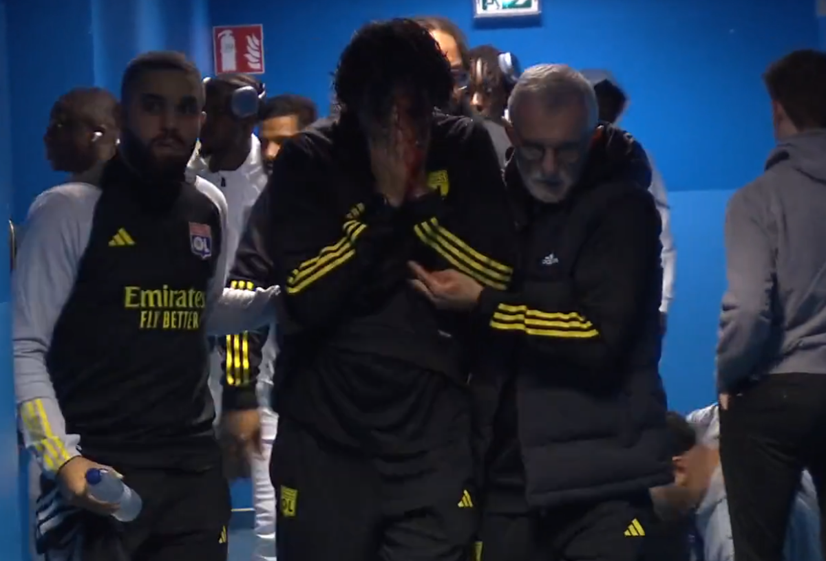 Cum arată fața lui Fabio Grosso, a doua zi după ce a fost atacat cu pietre de ultrașii lui Marseille