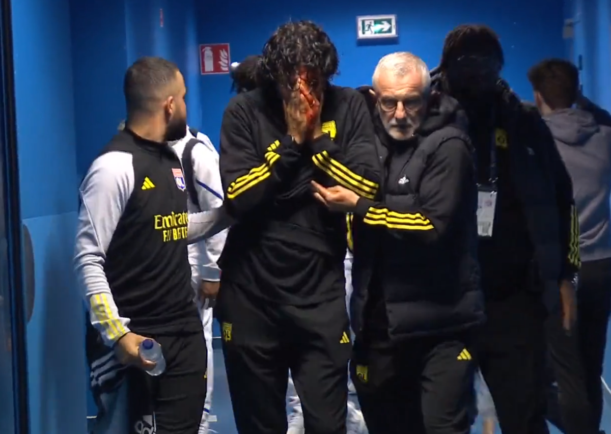 Cum arată fața lui Fabio Grosso, a doua zi după ce a fost atacat cu pietre de ultrașii lui Marseille