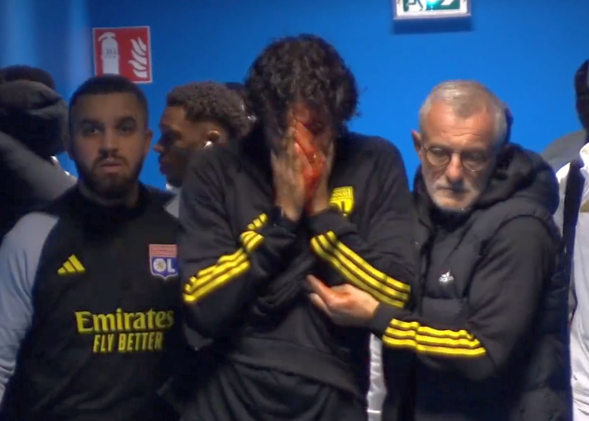 Imagini ȘOCANTE din Franța! Antrenorul lui Lyon, plin de sânge după ce autocarul a fost atacat de ultrașii lui Marseille! Meciul a fost AMÂNAT