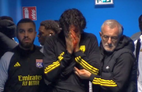 Imagini ȘOCANTE din Franța! Antrenorul lui Lyon, plin de sânge după ce autocarul a fost atacat de ultrașii lui Marseille! Meciul a fost AMÂNAT