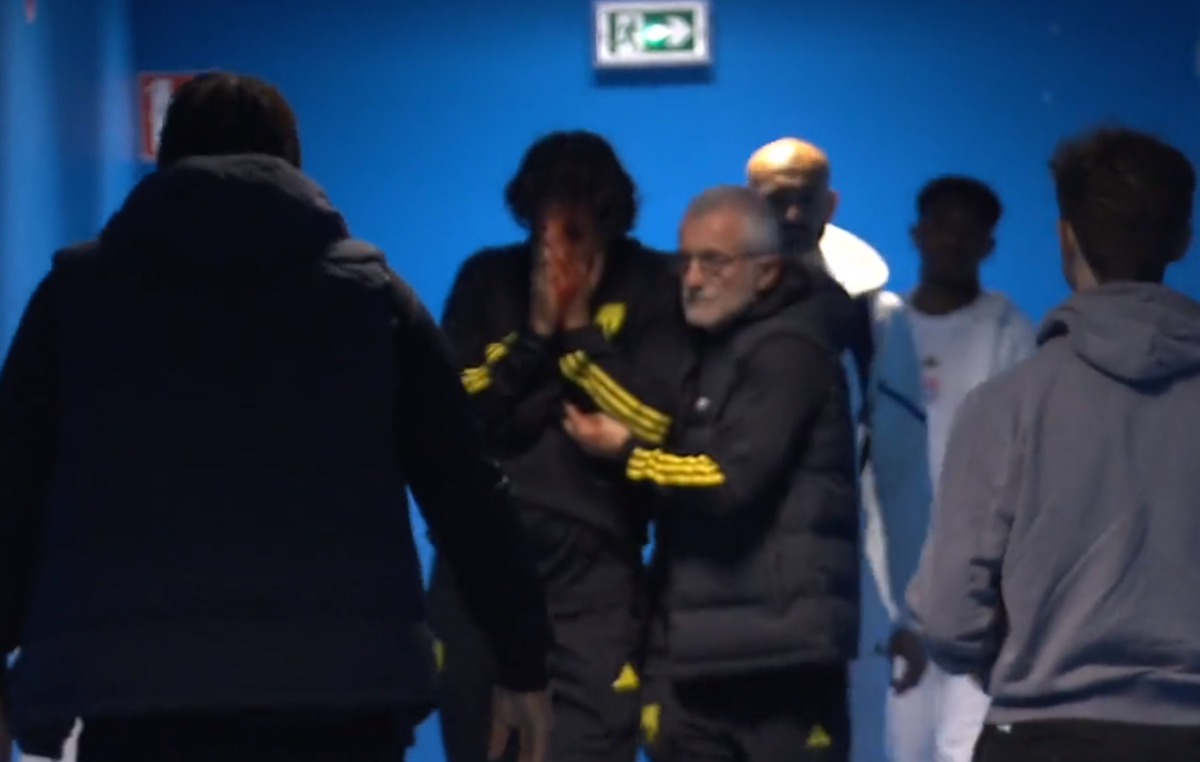 Imagini ȘOCANTE din Franța! Antrenorul lui Lyon, plin de sânge după ce autocarul a fost atacat de ultrașii lui Marseille! Meciul a fost AMÂNAT