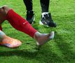 David Miculescu a ajuns la spital după accidentarea din Gloria Bistrița - FCSB, Cupa României. foto: Andrei Furnigă / GSP