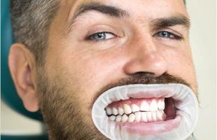 Cum să ai dinții mai albi? Află ce soluții eficiente există