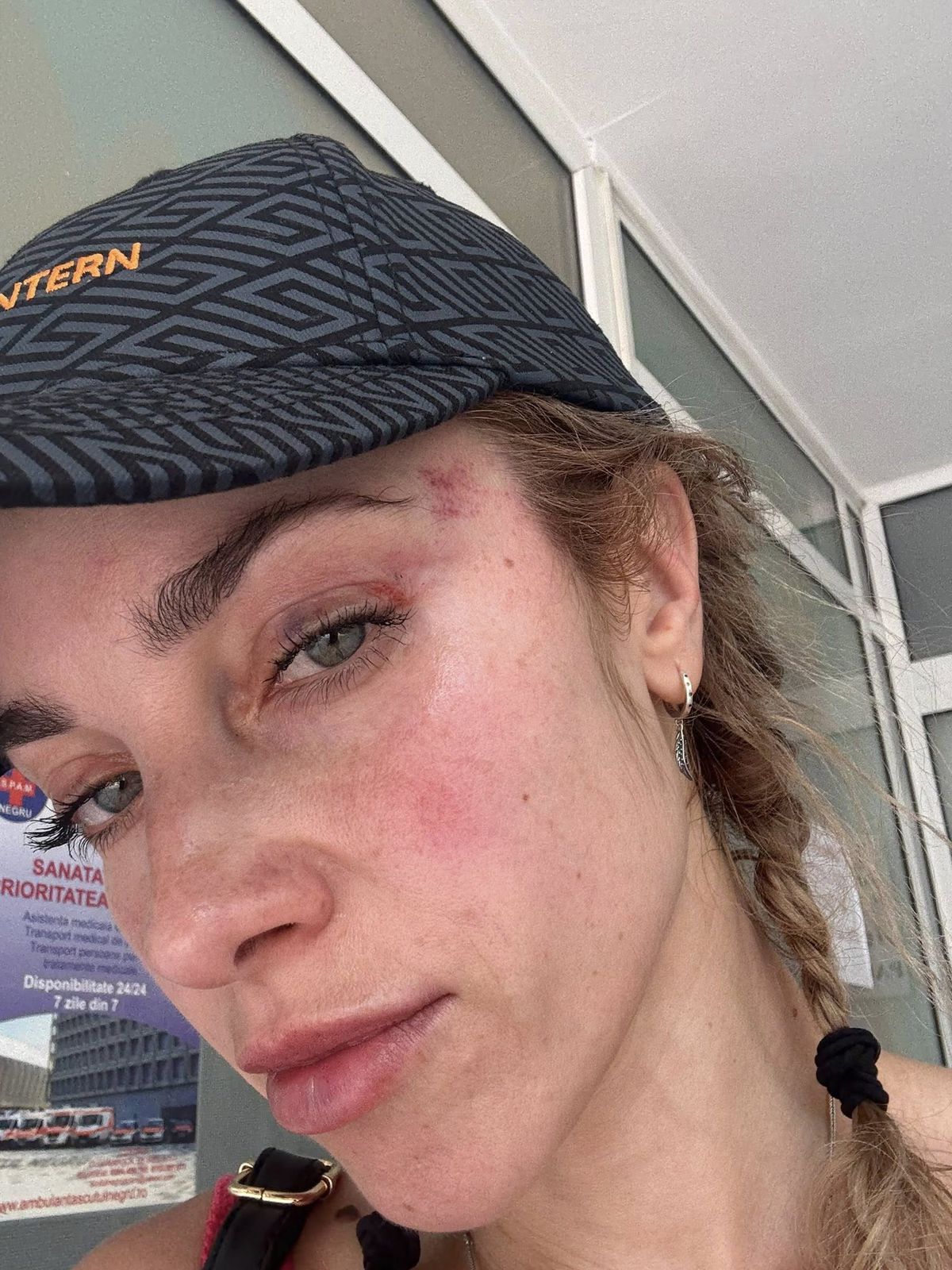 Scene șocante la Cluj! O femeie a fost bătută de un fan U Cluj în parc: „A presupus că sunt ucraineancă și că nu am niciun drept aici” / Dreptul la replică al bărbatului