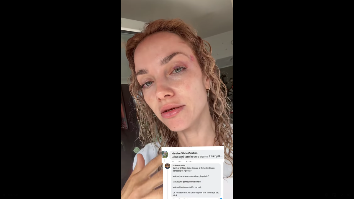 Scene șocante la Cluj! O femeie a fost bătută de un fan U Cluj în parc: „A presupus că sunt ucraineancă și că nu am niciun drept aici” / Dreptul la replică al bărbatului