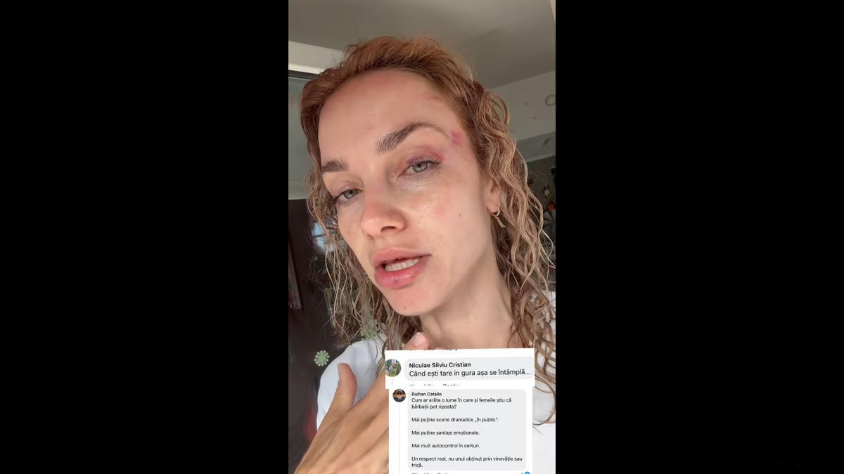 Scene șocante la Cluj! O femeie a fost bătută de un fan U Cluj în parc: „A presupus că sunt ucraineancă și că nu am niciun drept aici” / Dreptul la replică al bărbatului