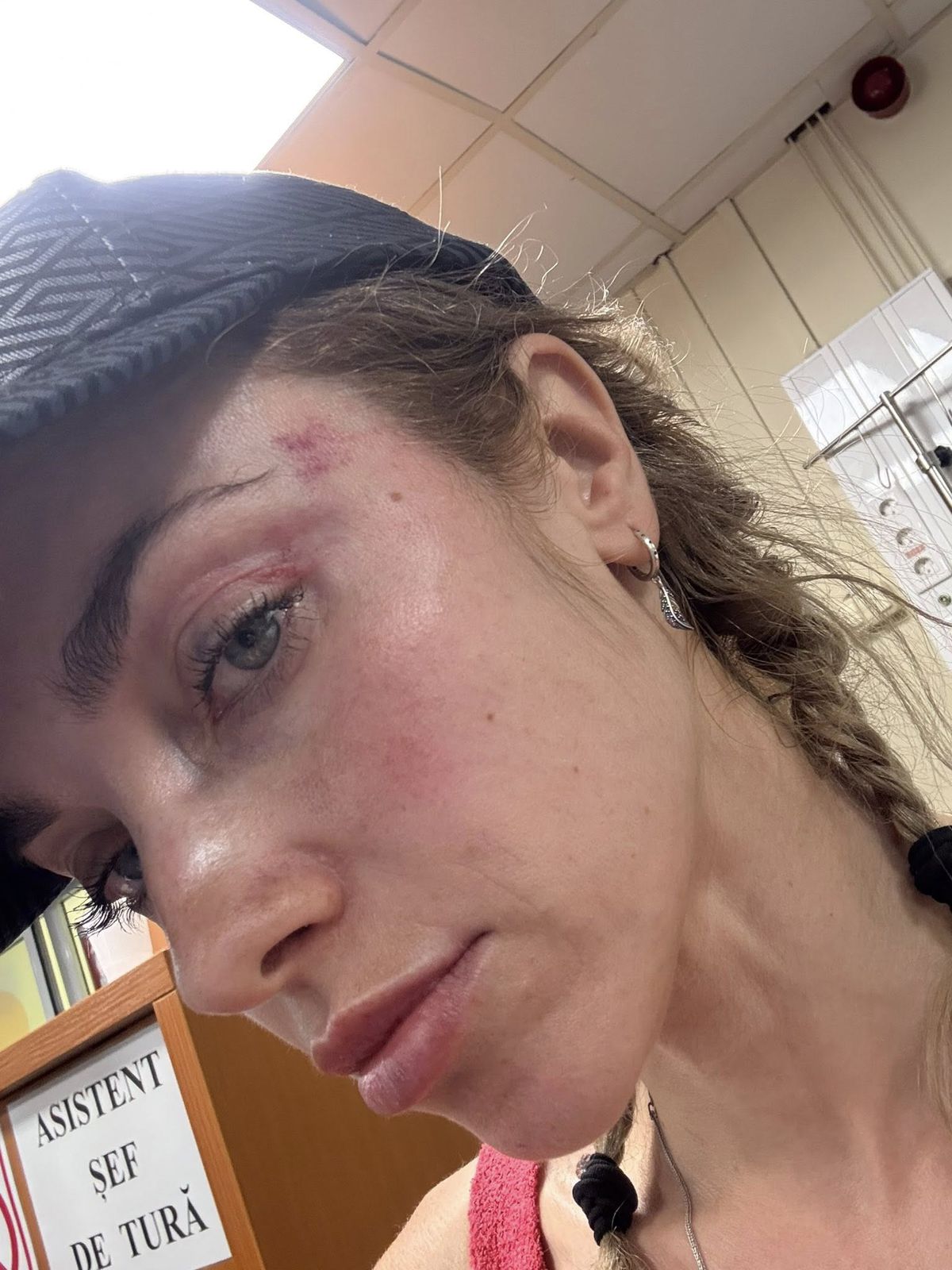 Scene șocante la Cluj! O femeie a fost bătută de un fan U Cluj în parc: „A presupus că sunt ucraineancă și că nu am niciun drept aici” / Dreptul la replică al bărbatului