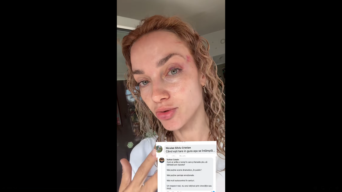 Scene șocante la Cluj! O femeie a fost bătută de un fan U Cluj în parc: „A presupus că sunt ucraineancă și că nu am niciun drept aici” / Dreptul la replică al bărbatului