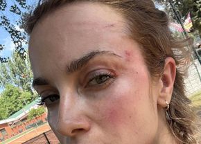 Scene șocante la Cluj! O femeie a fost bătută de un fan U Cluj în parc: „A presupus că sunt ucraineancă și că nu am niciun drept aici”