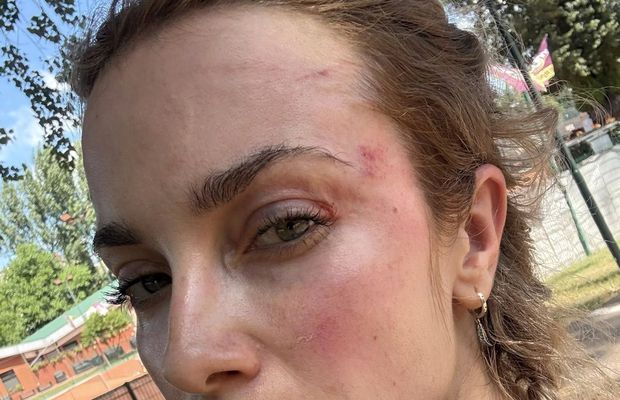 Scene șocante la Cluj! O femeie a fost bătută de un fan U Cluj în parc: „A presupus că sunt ucraineancă și că nu am niciun drept aici” / Dreptul la replică al bărbatului