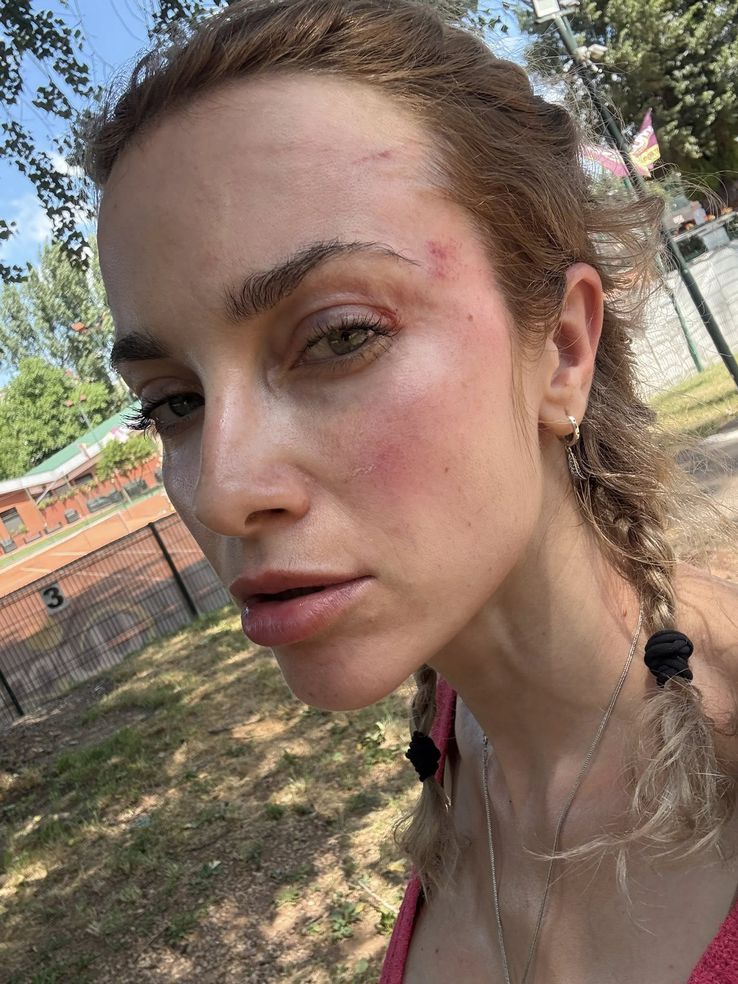 O femeie a fost bătută în Cluj de un suporter al Universității. FOTO: Facebook @Siuko Siu