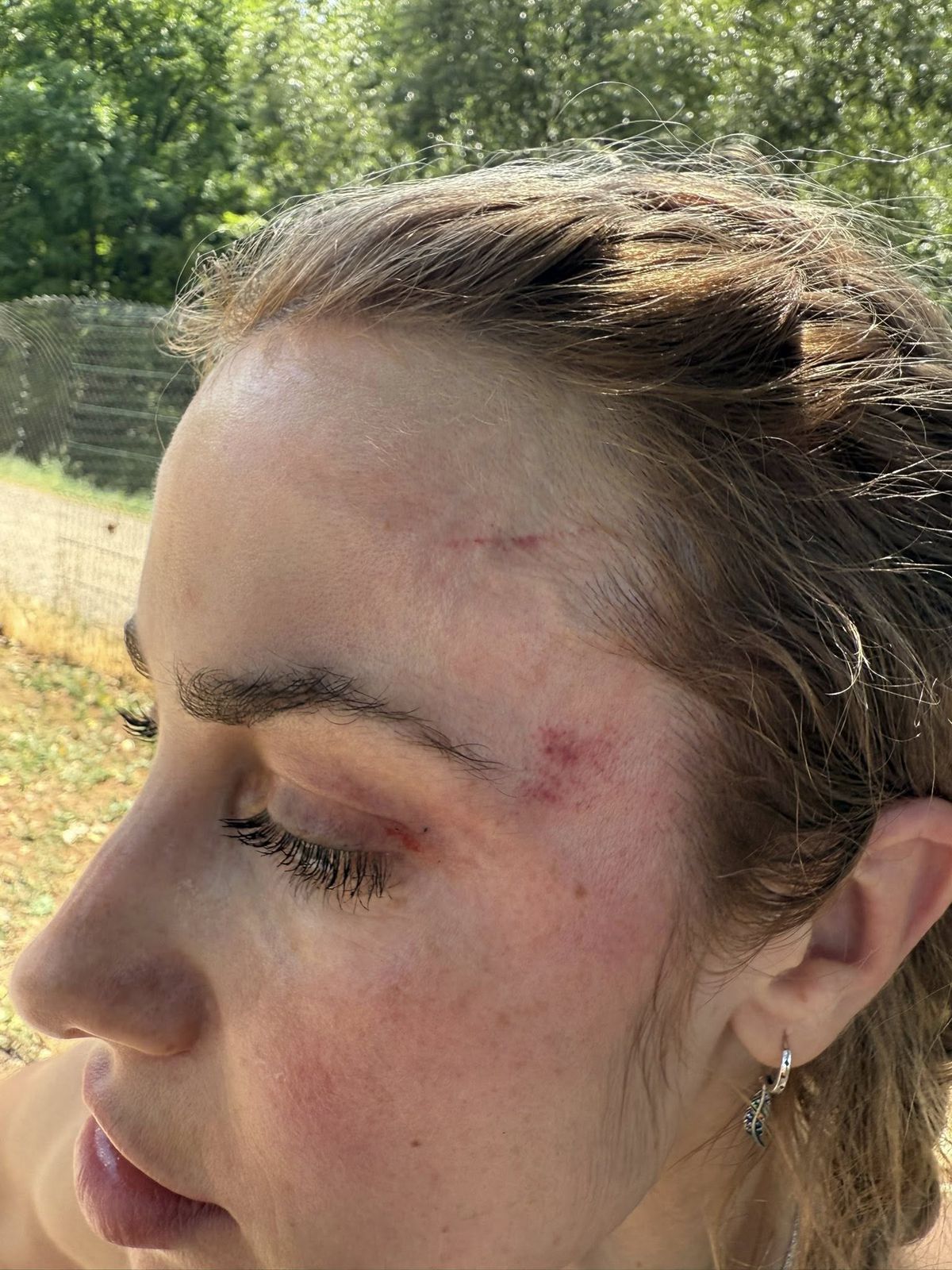 Scene șocante la Cluj! O femeie a fost bătută de un fan U Cluj în parc: „A presupus că sunt ucraineancă și că nu am niciun drept aici” / Dreptul la replică al bărbatului