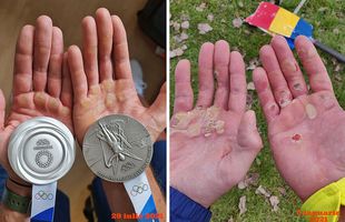 Medaliile care dor: bătăturile și argintul de la Tokyo » Cum arată sacrificiul făcut de Cozmiuc și Tudosă pentru medalia la Jocurile Olimpice