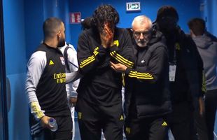 Cum arată fața lui Fabio Grosso, a doua zi după ce a fost atacat cu pietre de ultrașii lui Marseille