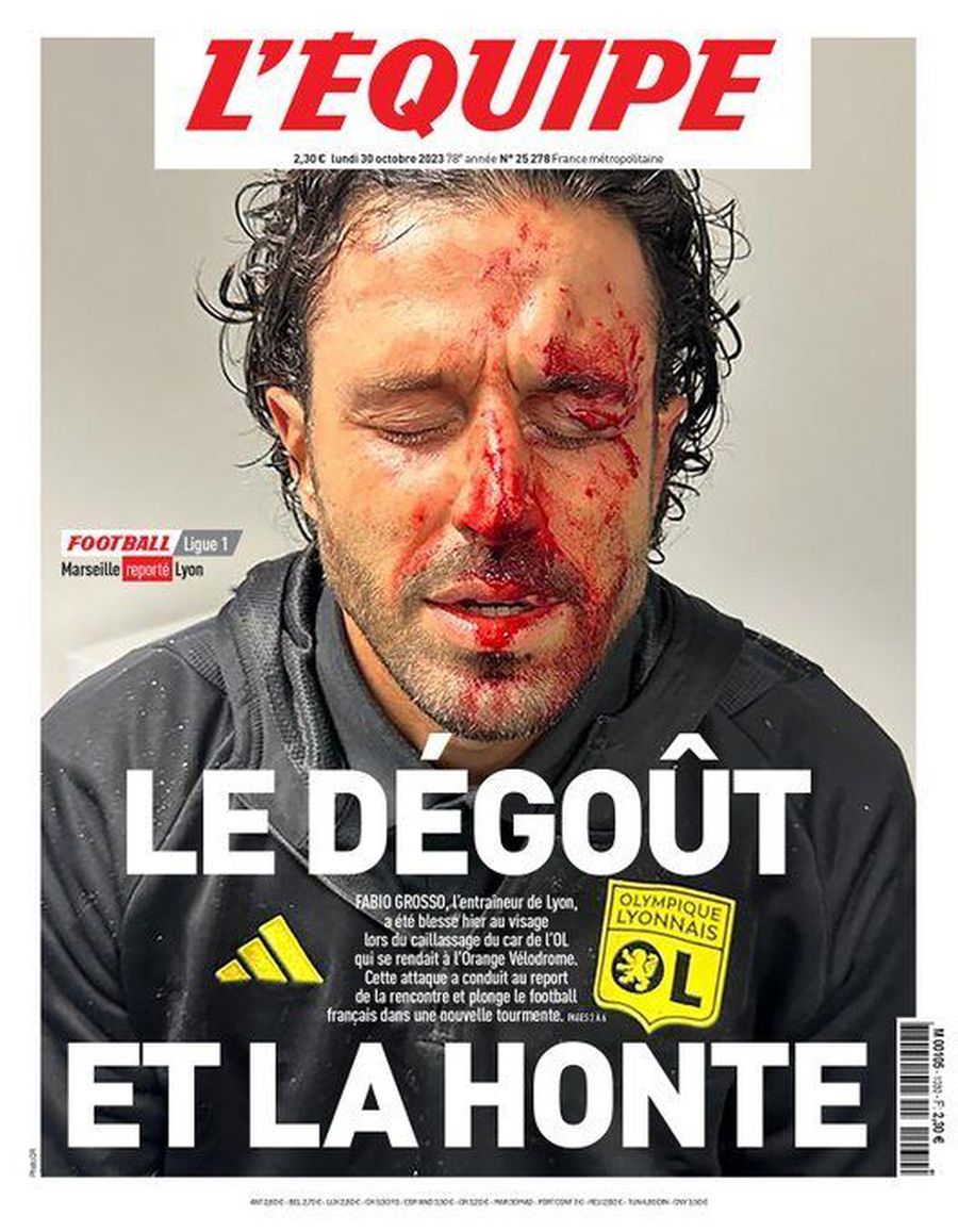 Comoție și 10 puncte de sutură pentru Fabio Grosso! Ministrul Sportului francez atacă dur: „E deprimant și dezgustător”