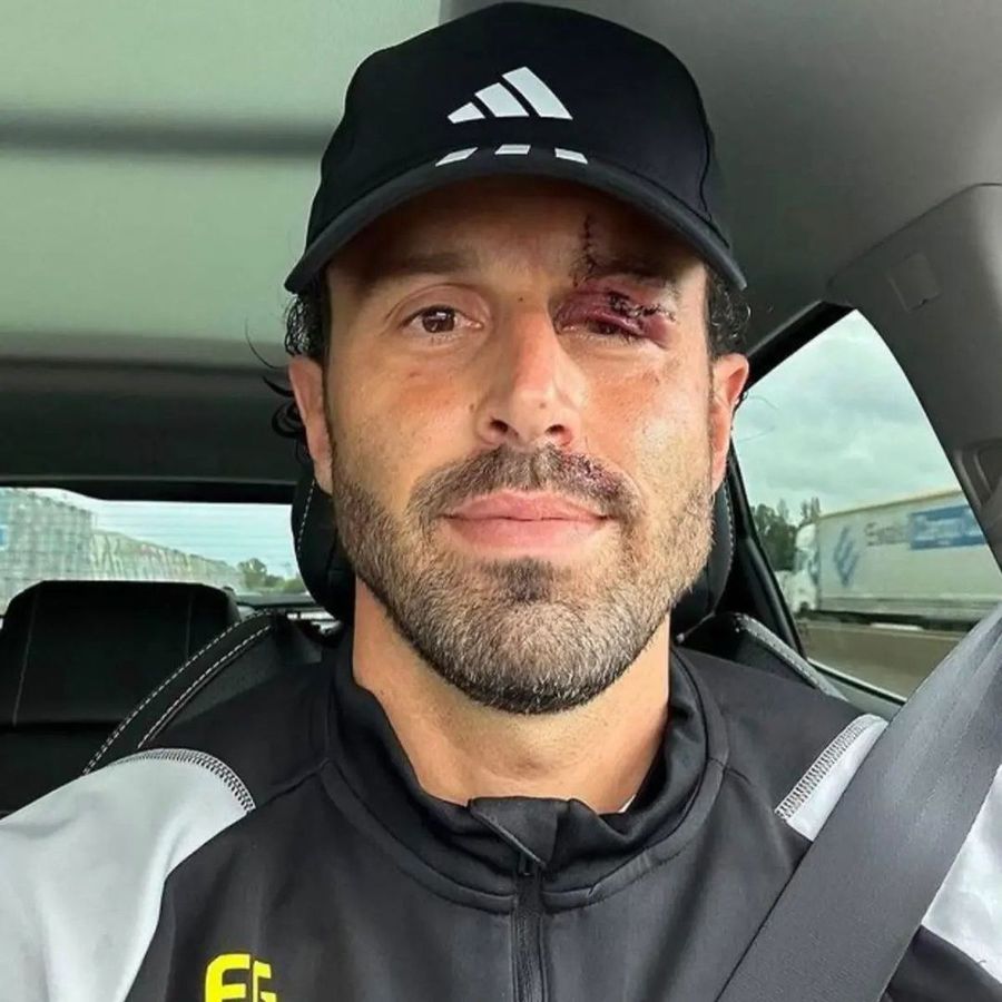 Cum arată fața lui Fabio Grosso, a doua zi după ce a fost atacat cu pietre de ultrașii lui Marseille