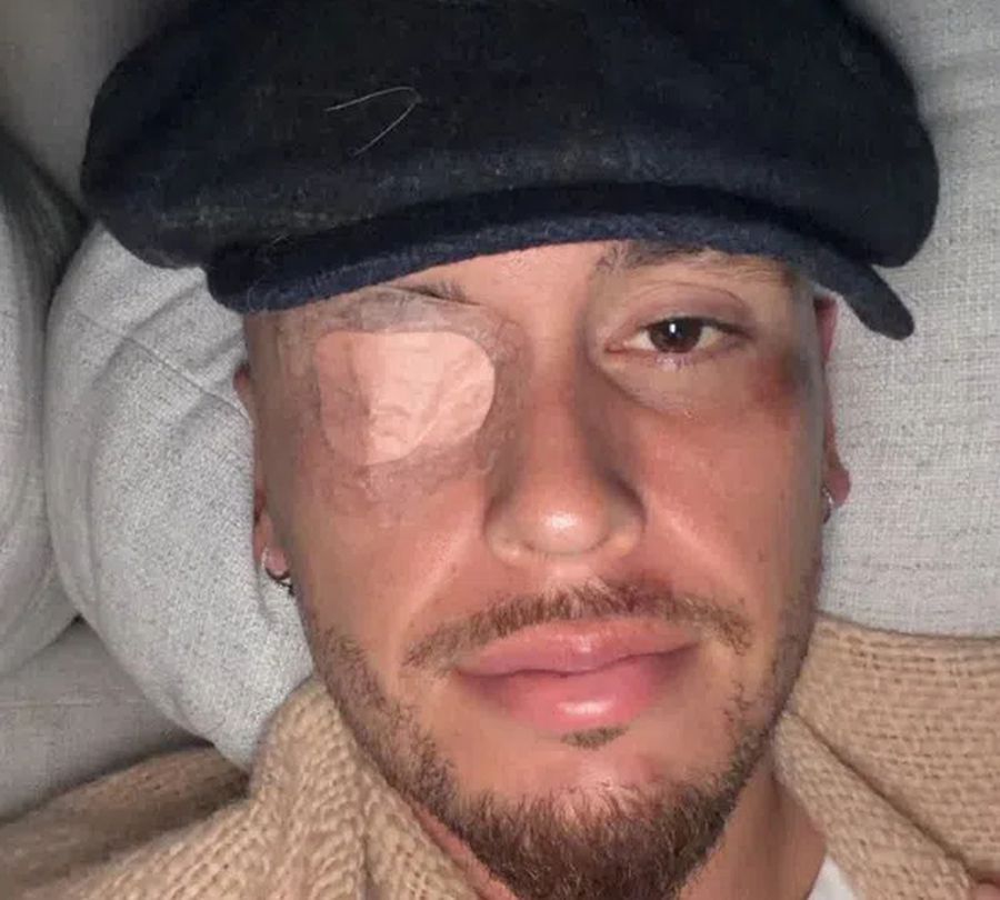 foto: instagram @lucasocampos11 Și-a speriat fanii » Internaționalul argentinian a suferit paralizie facială