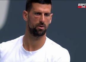 Care este motivul pentru care Novak Djokovic a apărut cu ochiul umflat și vânăt la Miami Open