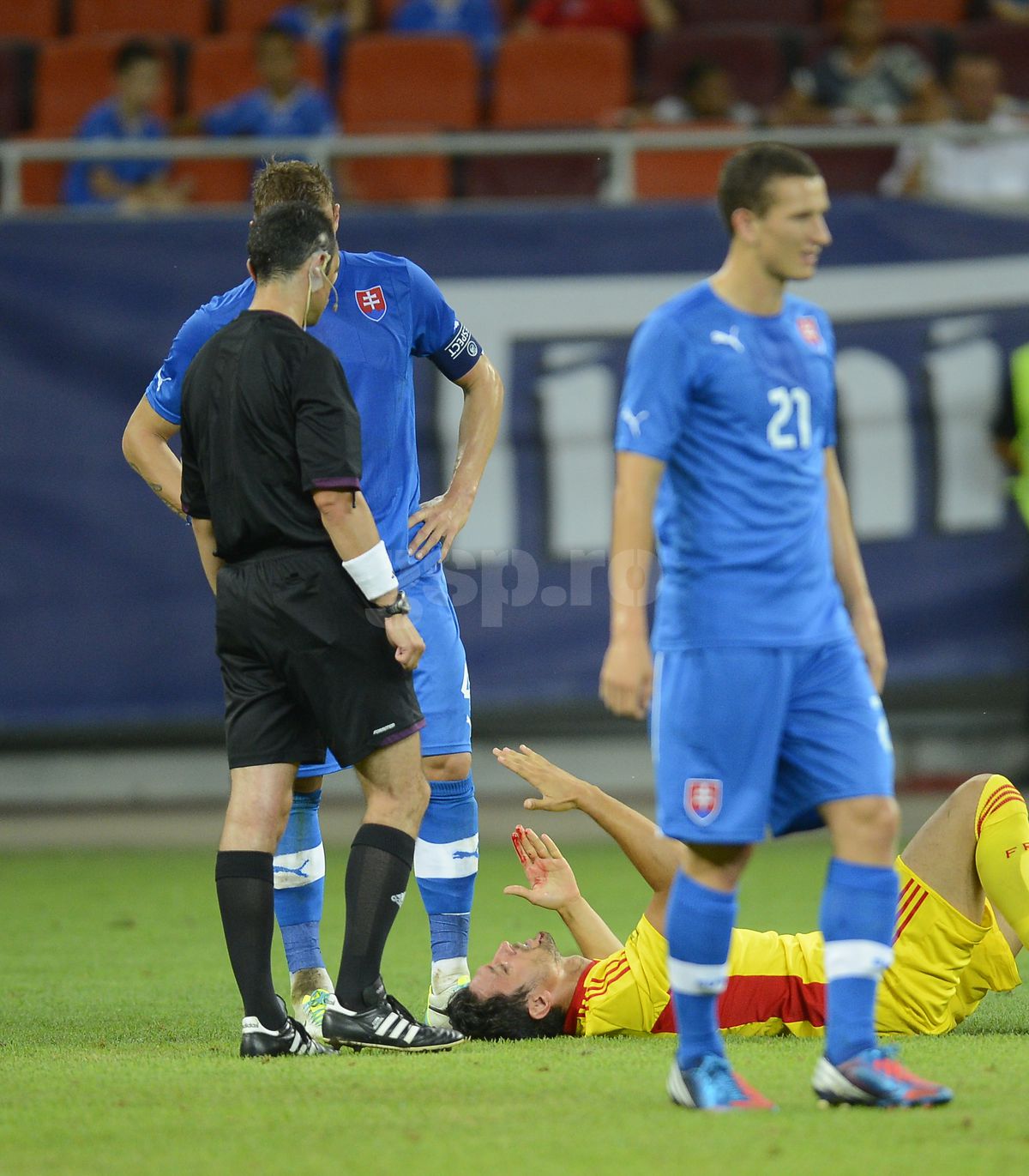 Imagini horror de la România - Slovacia: „Doctorul m-a cusut pe viu pe banca de rezerve”